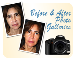 Before & After Galleries